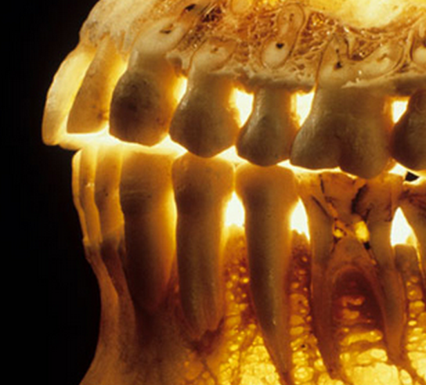 Prevent Bone Loss After Tooth Loss