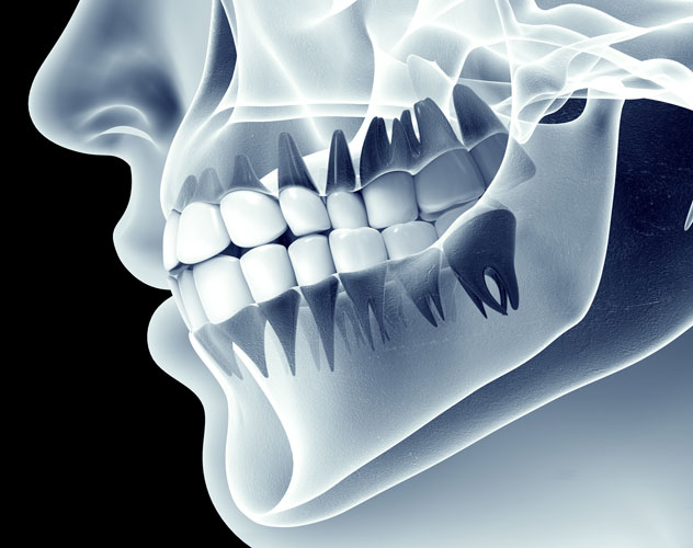 Dental Oral CT Scan